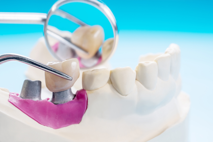 STHIRA Dentistry & Facial Surgery, Dr. Bhargav Kuchu