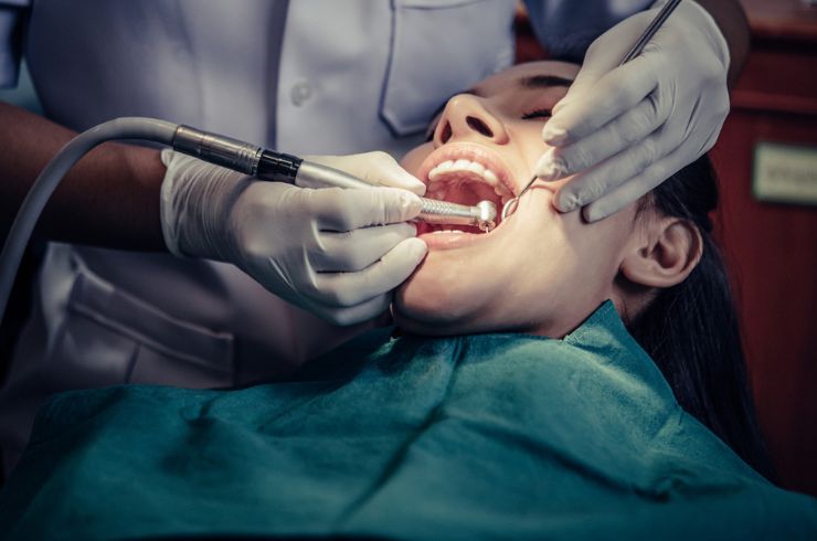 teeth Fillings STHIRA Dentistry & Facial Surgery, Dr. Bhargav Kuchu