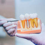 STHIRA Dentistry & Facial Surgery, Dr. Bhargav Kuchu
