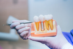 STHIRA Dentistry & Facial Surgery, Dr. Bhargav Kuchu